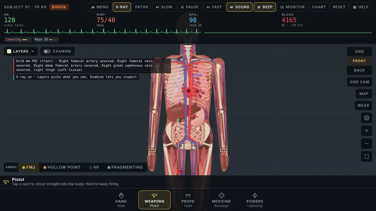Trauma Lab X-ray view showing bones, vessels, and organs, with Layers and Examine. Official itch.io screenshot.
