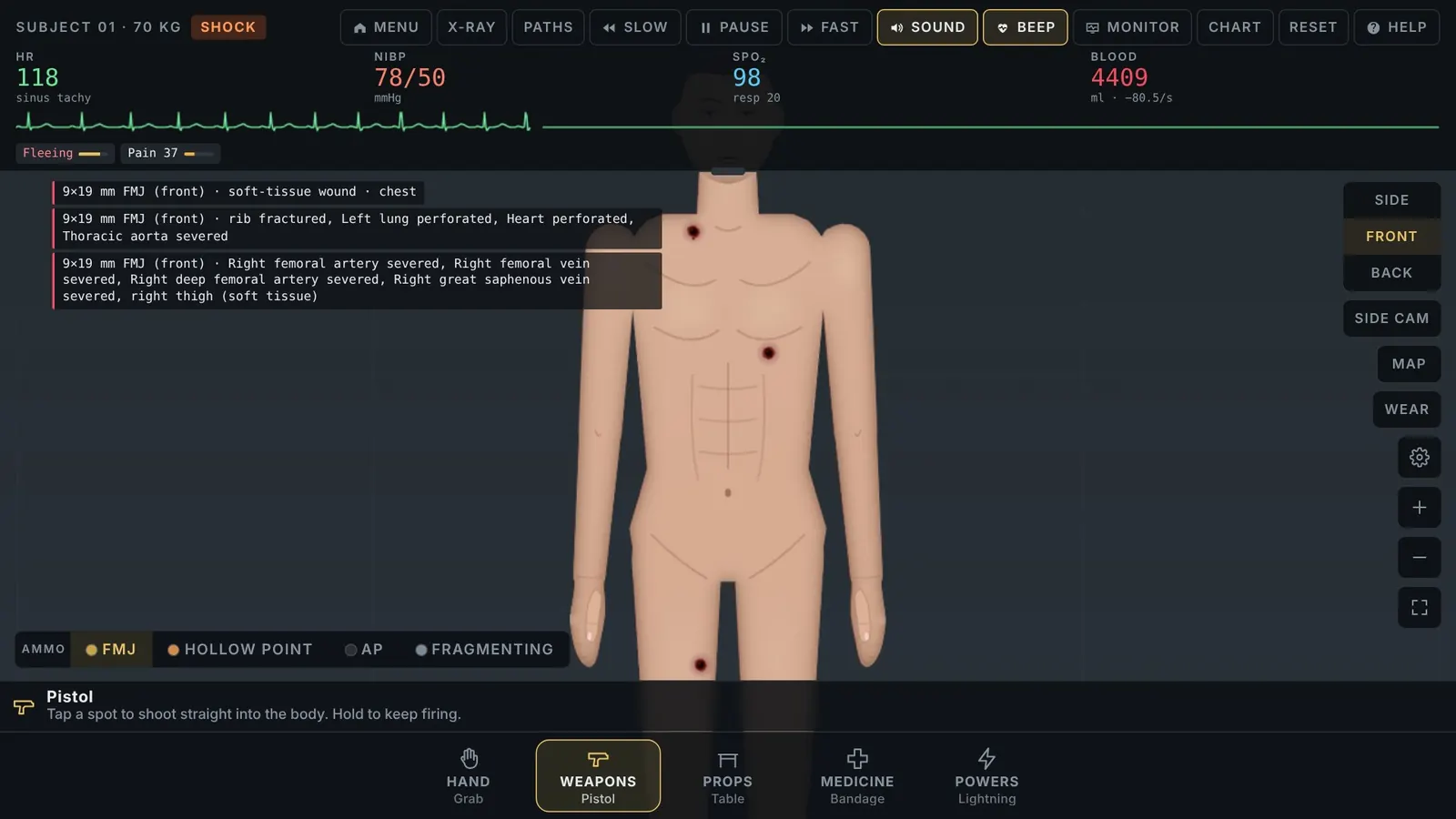 Trauma Lab front view of a gunshot with shock and bleeding readouts. Official itch.io screenshot.